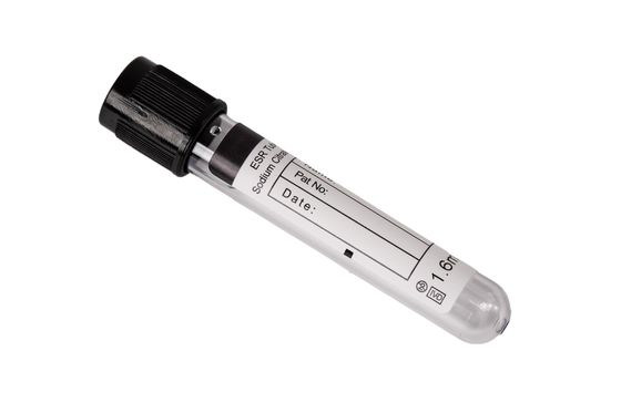 7ml 8ml 9ml 10ml ESR Cam Tüp Antikoagulant Kan Tüpleri ESR için