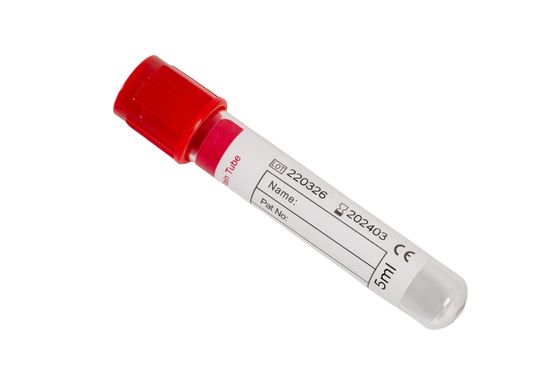 2 ml Kan Toplama Tüpü Müşterinin İhtiyaçlarına Uygun