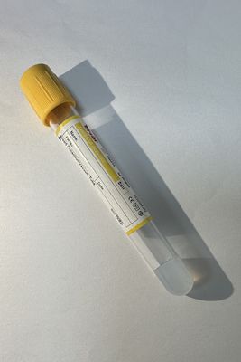 Tubo de análisis de sangre Detección de enfermedades infecciosas Tecnología de separación inteligente Aceleración rápida de la coagulación